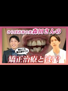 [x]【矯正医が教える】さらば青春の光 森田さんの矯正治療とは！？ - YouTube