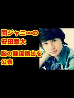 [x]【芸能・エンタメ】関ジャニ∞の安田章大、脳の腫瘍摘出を公表 病名は髄膜腫 早期発見で良性 - YouTube