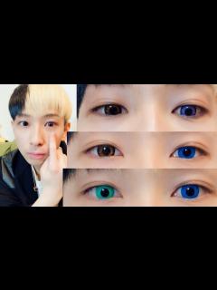 [x]【驚愕の変化】たった10万円で目をいじった結果… - YouTube